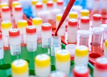 Bluttest-Skandal spitzt sich zu