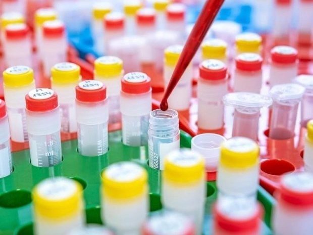 Bluttest-Skandal spitzt sich zu