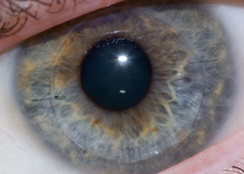 Blinder kann wieder sehen