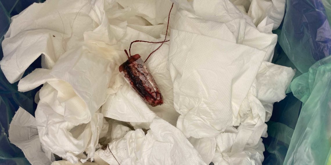 Warum Frauen* Pinky Gloves absolut nicht brauchen