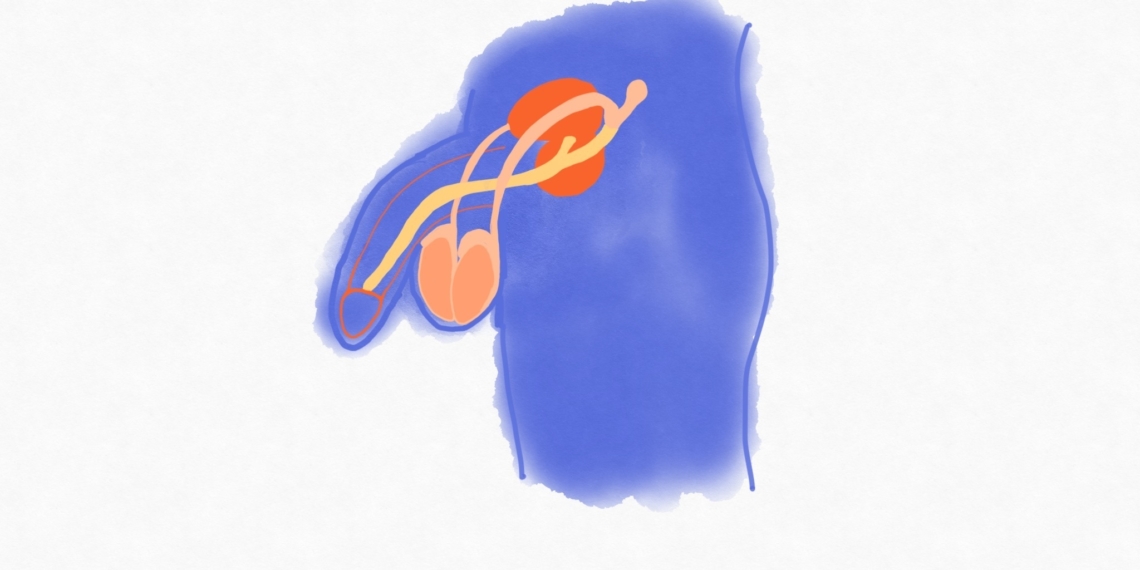 Schwangerschaft? Mann verhüte!