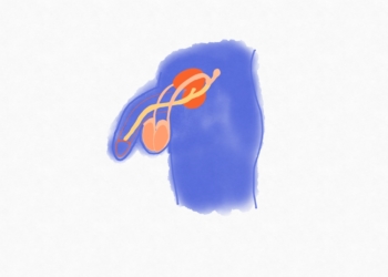 Schwangerschaft? Mann verhüte!